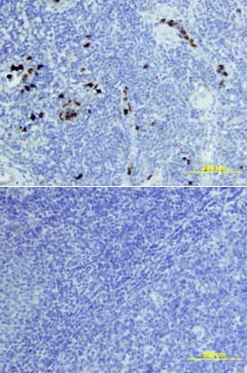 EN-RAGE/S100A12 was detected in immersion fixed paraffin-embedded sections of human tonsil using Goat Anti-Human EN-RAGE/S100A12 Biotinylated Antigen Affinity-purified Polyclonal Antibody (Catalog # BAF1052) at 10 µg/mL overnight at 4 °C. Tissue was stained using the Anti-Goat HRP-DAB Cell & Tissue Staining Kit (brown; Catalog # CTS008) and counterstained with hematoxylin (blue). Lower panel shows a lack of labeling if primary antibodies are omitted and tissue is stained only with secondary antibody followed by incubation with detection reagents. View our protocol for Chromogenic IHC Staining of Paraffin-embedded Tissue Sections.