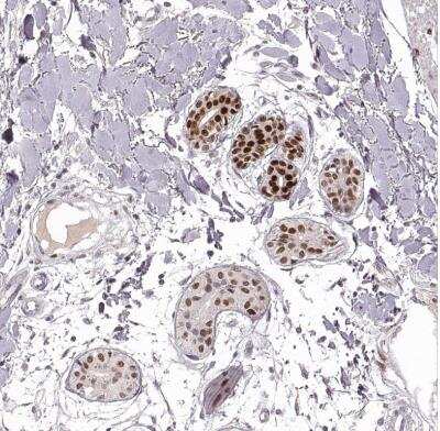 Immunohistochemistry-Paraffin: EN1/Engrailed 1 Antibody [NBP2-57757] - Staining of human skin shows strong nuclear positivity in sweat glands.