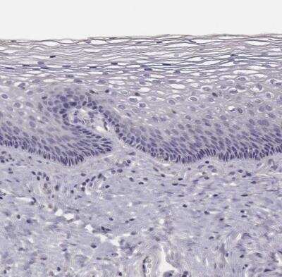 EN1/Engrailed 1 Antibody (NBP2-57757): Novus Biologicals