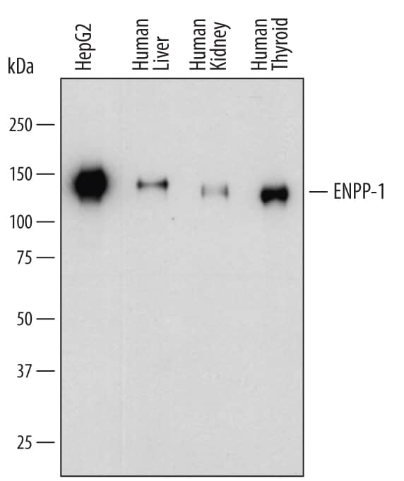 Western blot shows lysates of HepG2 human hepatocellular carcinoma cell line, human liver tissue, human kidney tissue, and human thyroid tissue. PVDF membrane was probed with 1 µg/mL of Sheep Anti-Human ENPP-1 Antigen Affinity-purified Polyclonal Antibody (Catalog # AF6136) followed by HRP-conjugated Anti-Sheep IgG Secondary Antibody (Catalog # HAF016). A specific band was detected for ENPP-1 at approximately 130-150 kDa (as indicated). This experiment was conducted under reducing conditions and using Immunoblot Buffer Group 1.