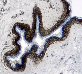 EPCR was detected in immersion fixed paraffin-embedded sections of human skin using 25 µg/mL Mouse Anti-Human EPCR Monoclonal Antibody (Catalog # MAB22451) overnight at 4 °C. Tissue was stained with the Anti-Mouse HRP-DAB Cell & Tissue Staining Kit (brown; Catalog # CTS002) and counterstained with hematoxylin (blue). View our protocol for Chromogenic IHC Staining of Paraffin-embedded Tissue Sections.