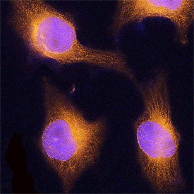 ERp57/PDIA3 was detected in immersion fixed HeLa human cervical epithelial carcinoma cell line using Sheep Anti-Human ERp57/PDIA3 Antigen Affinity-purified Polyclonal Antibody (Catalog # AF8219) at 15 µg/mL for 3 hours at room temperature. Cells were stained using the NorthernLights™ 557-conjugated Anti-Sheep IgG Secondary Antibody (red; Catalog # NL010) and counterstained with DAPI (blue). Specific staining was localized to cytoplasm. View our protocol for Fluorescent ICC Staining of Cells on Coverslips.