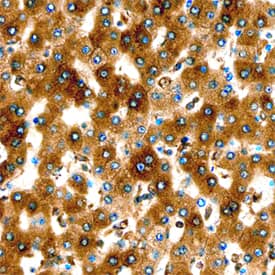 ERp57/PDIA3 was detected in immersion fixed paraffin-embedded sections of human liver using Sheep Anti-Human ERp57/PDIA3 Antigen Affinity-purified Polyclonal Antibody (Catalog # AF8219) at 1 µg/mL overnight at 4 °C. Tissue was stained using the Anti-Sheep HRP-DAB Cell & Tissue Staining Kit (brown; Catalog # CTS019) and counterstained with hematoxylin (blue). Specific staining was localized to the cytoplasm of hepatocytes. View our protocol for Chromogenic IHC Staining of Paraffin-embedded Tissue Sections.