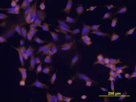 ESAM was detected in immersion fixed HUVEC human umbilical vein endothelial cells using Mouse Anti-Human ESAM Monoclonal Antibody (Catalog # MAB4204) at 10 µg/mL for 3 hours at room temperature. Cells were stained using the NorthernLights™ 557-conju-gated Anti-Mouse IgG Secondary Antibody (yellow; Catalog # NL007) and counterstained with DAPI (blue). View our protocol for Fluorescent ICC Staining of Cells on Coverslips.