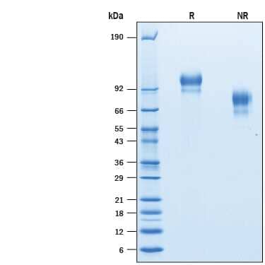 2 μg/lane of Recombinant Human E-Selectin/CD62E His-tag was  resolved with SDS-PAGE under reducing (R) and non-reducing (NR)  conditions and visualized by Coomassie® Blue staining, showing bands at 84-109 kDa and 60-84 kDa, respectively .