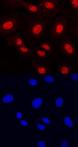 ETV5 was detected in immersion fixed BT-20 human breast cancer cell line using Mouse Anti-Human ETV5 Monoclonal Antibody (Catalog # MAB7107) at 10 µg/mL for 3 hours at room temperature. Cells were stained using the NorthernLights™ 557-conjugated Anti-Mouse IgG Secondary Antibody (red, upper panel; Catalog # NL007) and counterstained with DAPI (blue, lower panel). Specific staining was localized to nuclei. View our protocol for Fluorescent ICC Staining of Cells on Coverslips.