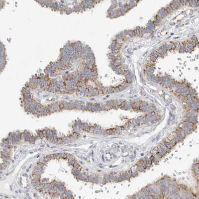 Immunohistochemistry-Paraffin: Elp3 Antibody [NBP1-84625] - Staining of human fallopian tube shows moderate cytoplasmic positivity in glandular cells.