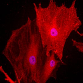 Endoglin/CD105 was detected in immersion fixed undifferentiated rat mesenchymal stem cells using Goat Anti-Rat Endoglin/CD105 Antigen Affinity-purified Polyclonal Antibody (Catalog # AF6440) at 10 µg/mL for 3 hours at room temperature. Cells were stained using the NorthernLights™ 557-conjugated Anti-Goat IgG Secondary Antibody (red; Catalog # NL001) and counterstained with DAPI (blue). Specific staining was localized to the transmembrane. View our protocol for Fluorescent ICC Staining of Stem Cells on Coverslips.