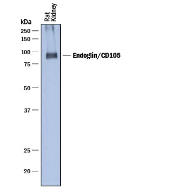 Western blot shows lysates of rat kidney tissue. PVDF membrane was probed with 1 µg/mL of Goat Anti-Rat Endoglin/CD105 Antigen Affinity-purified Polyclonal Antibody (Catalog # AF6440) followed by HRP-conjugated Anti-Goat IgG Secondary Antibody (Catalog # HAF017). A specific band was detected for Endoglin/CD105 at approximately 90 kDa (as indicated). This experiment was conducted under reducing conditions and using Immunoblot Buffer Group 1.