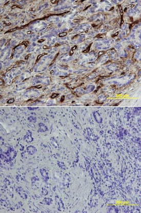 Endoglin/CD105 was detected in immersion fixed paraffin-embedded sections of human prostate array using Goat Anti-Human Endoglin/CD105 Biotinylated Antigen Affinity-purified Polyclonal Antibody (Catalog # BAF1097) at 15 µg/mL overnight at 4 °C. Tissue was stained using the Anti-Goat HRP-DAB Cell & Tissue Staining Kit (brown; Catalog # CTS008) and counterstained with hematoxylin (blue). Lower panel shows a lack of labeling if primary antibodies are omitted and tissue is stained only with secondary antibody followed by incubation with detection reagents. View our protocol for Chromogenic IHC Staining of Paraffin-embedded Tissue Sections.