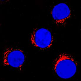 Endophilin B1/Bif-1 was detected in immersion fixed Jurkat human acute T cell leukemia cell line using Sheep Anti-Human Endophilin B1/Bif-1 Antigen Affinity-purified Polyclonal Antibody (Catalog # AF7456) at 5 µg/mL for 3 hours at room temperature. Cells were stained using the NorthernLights™ 557-conjugated Anti-Sheep IgG Secondary Antibody (red; Catalog # NL010) and counterstained with DAPI (blue). Specific staining was localized to cytoplasm. View our protocol for Fluorescent ICC Staining of Non-adherent Cells.