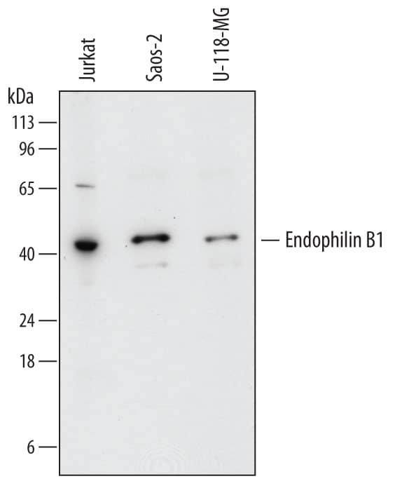 Western blot shows lysates of Jurkat human acute T cell leukemia cell line, Saos-2 human osteosarcoma cell line, and U-118-MG human glioblastoma/astrocytoma cell line. PVDF membrane was probed with 1 µg/mL of Sheep Anti-Human Endophilin B1/Bif-1 Antigen Affinity-purified Polyclonal Antibody (Catalog # AF7456) followed by HRP-conjugated Anti-Sheep IgG Secondary Antibody (Catalog # HAF016). A specific band was detected for Endophilin B1/Bif-1 at approximately 43 kDa (as indicated). This experiment was conducted under reducing conditions and using Immunoblot Buffer Group 1.