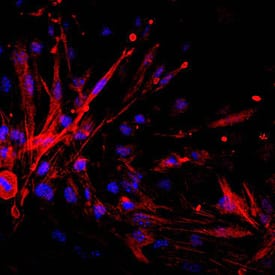 Endosialin/CD248 was detected in immersion fixed bEnd.3 mouse endothelioma cell line using Rat Anti-Mouse Endosialin/CD248 Monoclonal Antibody (Catalog # MAB7535) at 10 µg/mL for 3 hours at room temperature. Cells were stained using the NorthernLights™ 557-conjugated Anti-Rat IgG Secondary Antibody (red; Catalog # NL013) and counterstained with DAPI (blue). Specific staining was localized to cell surfaces and cytoplasm. View our protocol for Fluorescent ICC Staining of Cells on Coverslips.