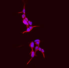 Endosialin/CD248 was detected in immersion fixed IMR-32 human neuroblastoma cell line using Rat Anti-Mouse Endosialin/CD248 Monoclonal Antibody (Catalog # MAB7535) at 10 µg/mL for 3 hours at room temperature. Cells were stained using the NorthernLights™ 557-conjugated Anti-Rat IgG Secondary Antibody (red; Catalog # NL013) and counterstained with DAPI (blue). Specific staining was localized to cell surfaces and cytoplasm. View our protocol for Fluorescent ICC Staining of Cells on Coverslips.