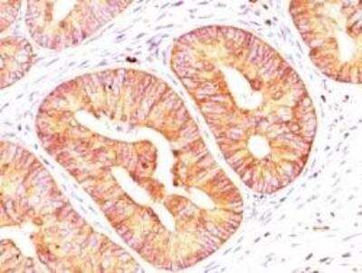 Immunohistochemistry-Paraffin: EpCAM/TROP1 Antibody [NBP2-27361] - Formalin-fixed, paraffin-embedded human colon stained with EpCAM antibody (1:200), peroxidase-conjugate and DAB chromogen.