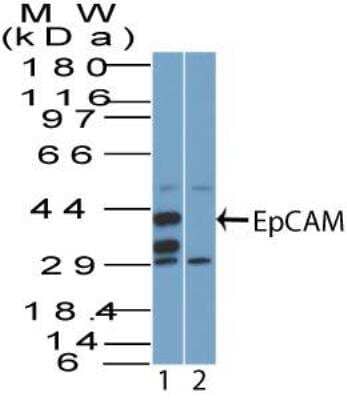 Western Blot: EpCAM/TROP1 Antibody [NBP2-27361] - Analysis of EpCAM using EpCAM antibody. Human HCT116 cell lysate in the 1) absence and 2) presence of immunizing peptide probed with 3 ug/ml of EpCAM antibody. I goat anti-rabbit Ig HRP secondary antibody and PicoTect ECL substrate solution were used for this test.