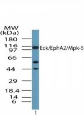 Western Blot: EphA2 Antibody [NBP2-24489] - Analysis of human EphA2 in human ovary lysate in the absence of immunizing peptide using NBP2-24489 at 1 ug/ml.