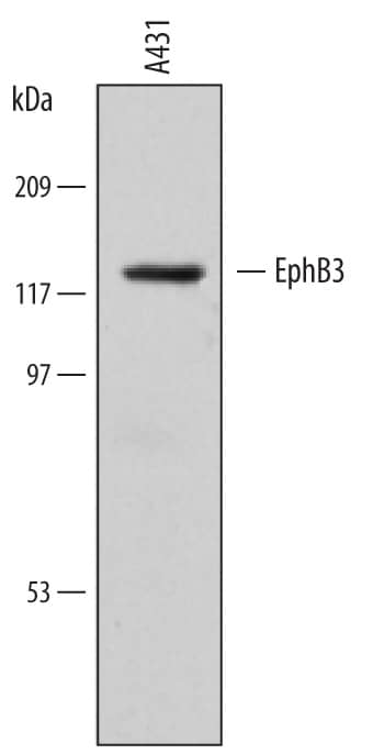         Western  blot shows lysates of human cerebellum tissue. PVDF membrane was probed with  2 µg/mL of Mouse Anti-Human EphB3 Monoclonal Antibody (Catalog #  MAB5667) followed by HRP-conjugated Anti-Mouse IgG Secondary Antibody  (Catalog # HAF018).  A specific band was detected for EphB3 at approximately 130 kDa (as  indicated). This experiment was conducted under reducing conditions and using  Immunoblot  Buffer Group 1.  