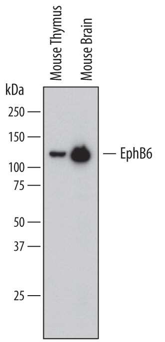 Western blot shows lysates of mouse thymus tissue and mouse brain tissue. PVDF membrane was probed with 1 µg/mL of Goat Anti-Mouse EphB6 Biotinylated Antigen Affinity-purified Polyclonal Antibody (Catalog # BAF611) followed by Streptavidin-HRP (Catalog # DY998). A specific band was detected for EphB6 at approximately 120 kDa (as indicated). This experiment was conducted under reducing conditions and using Immunoblot Buffer Group 1.