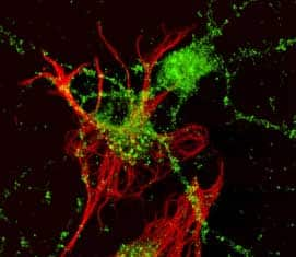 Immunocytochemistry Ephrin-A2 Antibody [Unconjugated]