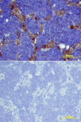 Ephrin-B2 was detected in perfusion fixed frozen sections of rat brain (trigeminal ganglia) using Goat Anti-Mouse Ephrin-B2 Biotinylated Antigen Affinity-purified Polyclonal Antibody (Catalog # BAF496) at 15 µg/mL overnight at 4 °C. Tissue was stained using the Anti-Goat HRP-DAB Cell & Tissue Staining Kit (brown; Catalog # CTS008) and counterstained with hematoxylin (blue). Lower panel shows a lack of labeling if primary antibodies are omitted and tissue is stained only with secondary antibody followed by incubation with detection reagents. View our protocol for Chromogenic IHC Staining of Frozen Tissue Sections.