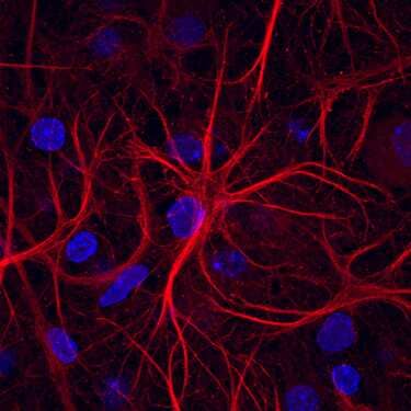 Ephrin-B2 was detected in immersion fixed rat hippocampal neurons using Goat Anti-Mouse Ephrin-B2 Biotinylated Antigen Affinity-purified Polyclonal Antibody (Catalog # BAF496) at 10 µg/mL for 3 hours at room temperature. Cells were stained using the NorthernLights™ 557-conjugated Streptavidin (red; Catalog # NL999) and counterstained with DAPI (blue). Specific staining was localized to cytoplasm and cell surface. View our protocol for Fluorescent ICC Staining of Non-adherent Cells.