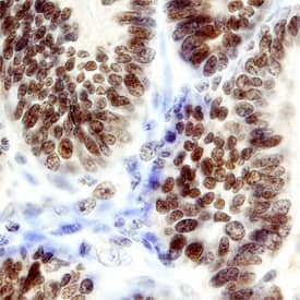 Ets-1 was detected in formalin fixed paraffin-embedded sections of human kidney using Mouse Anti-Human Ets-1 Monoclonal Antibody (Catalog # MAB7284) at 15 µg/mL overnight at 4 °C. Tissue was stained using the Anti-Mouse HRP-DAB Cell & Tissue Staining Kit (brown; Catalog # CTS002) and counterstained with hematoxylin (blue). Specific staining was localized to nuclei. View our protocol for Chromogenic IHC Staining of Paraffin-embedded Tissue Sections.