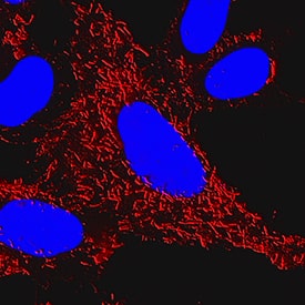     Ezrin  was detected in immersion fixed HeLa human cervical epithelial carcinoma cell  line using Rabbit Anti-Human Ezrin Monoclonal Antibody (Catalog # MAB7239) at  1 µg/mL for 3 hours at room temperature. Cells were  stained using the NorthernLights™ 557-conjugated Anti-Rabbit IgG  Secondary Antibody (red; Catalog # NL004)  and counterstained with DAPI (blue). Specific staining was localized to  cytoplasm. View our protocol for Fluorescent  ICC Staining of Cells on Coverslips. 