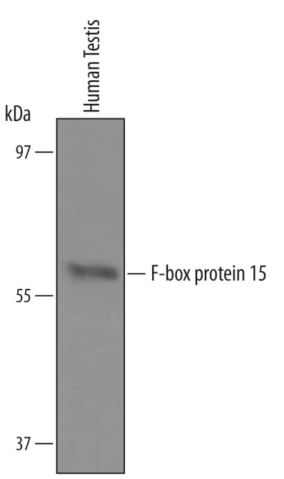 Western blot shows lysates of human testis tissue. PVDF Membrane was probed with 1 µg/mL of Sheep Anti-Human F-box protein 15/FBXO15 Antibody Antigen Affinity-purified Polyclonal Antibody (Catalog # AF6035) followed by HRP-conjugated Anti-Sheep IgG Secondary Antibody (Catalog # HAF016). A specific band was detected for F-box protein 15/FBXO15 at approximately 58 kDa (as indicated). This experiment was conducted under reducing conditions and using Immunoblot Buffer Group 1.