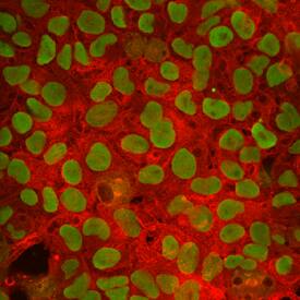 F-box protein 15/FBXO15 was detected in immersion fixed BG01V human embryonic stem cells using Mouse Anti-Human F-box protein 15/FBXO15 Monoclonal Antibody (Catalog # MAB6035) at 10 µg/mL for 3 hours at room temperature. Cells were stained using the NorthernLights™ 557-conjugated Anti-Mouse IgG Secondary Antibody (red; Catalog # NL007). Oct-3/4 was detected in cell nuclei using Goat Anti-Human Oct-3/4 Antigen Affinity-purified Polyclonal Antibody (Catalog # AF1759) and stained using NorthernLights™ 493-conjugated Anti-Goat IgG Secondary Antibody (green; Catalog # NL003). Specific staining of F-box protein 15 was localized to cytoplasm. View our protocol for Fluorescent ICC Staining of Cells on Coverslips.
