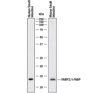 Western blot shows lysates of human small intestine tissue and mouse small intestine tissue. PVDF membrane was probed with 2 µg/mL of Mouse Anti-Human FABP2/I-FABP Monoclonal Antibody (Catalog # MAB30781) followed by HRP-conjugated Anti-Mouse IgG Secondary Antibody (Catalog # HAF018). A specific band was detected for FABP2/I-FABP at approximately 14 kDa (as indicated). This experiment was conducted under reducing conditions and using Immunoblot Buffer Group 1.