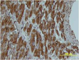 FABP3/H-FABP was detected in immersion fixed paraffin-embedded sections of human heart using Sheep Anti-Human FABP3/H-FABP Biotinylated Antigen Affinity-purified Polyclonal Antibody (Catalog # BAF1678) at 15 µg/mL overnight at 4 °C. Tissue was stained using the Anti-Sheep HRP-DAB Cell & Tissue Staining Kit (brown; Catalog # CTS019) and counterstained with hematoxylin (blue). Specific staining was localized to cytoplasm. View our protocol for Chromogenic IHC Staining of Paraffin-embedded Tissue Sections.