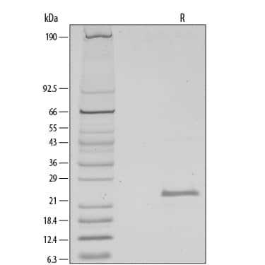 1 μg/lane of Recombinant Human FGF-21 was resolved with SDS-PAGE under reducing (R) conditions and visualized by silver staining, showing a single band at 24 kDa.