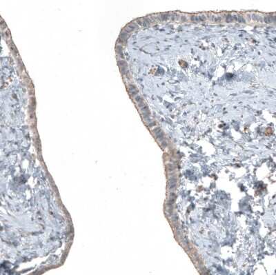 Immunohistochemistry-Paraffin: FGF R2 Antibody [NBP1-88670] - Staining of human Fallopian tube shows  moderate membranous positivity in glandular cells.