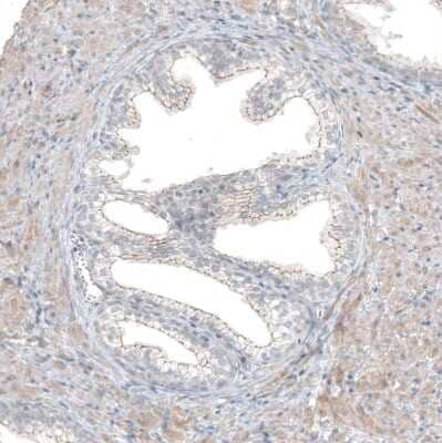 Immunohistochemistry-Paraffin: FGF R2 Antibody [NBP1-88670] - Staining of human prostate shows moderate membranous positivity in glandular cells and weak cytoplasmic staining of smooth muscle cells.