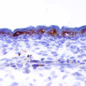 FGF R4 was detected in immersion fixed frozen sections of mouse embryo (E11.5) using Goat Anti-Mouse FGF R4 Biotinylated Antigen Affinity-purified Polyclonal Antibody (Catalog # BAF2265) at 15 µg/mL overnight at 4 °C. Tissue was stained using the Anti-Goat HRP-DAB Cell & Tissue Staining Kit (brown; Catalog # CTS008) and counterstained with hematoxylin (blue). Specific staining was localized to the epidermis. View our protocol for Chromogenic IHC Staining of Frozen Tissue Sections.