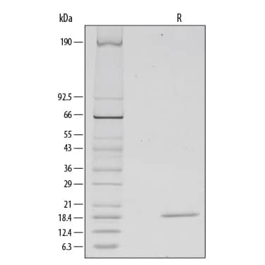 1 μg/lane of Recombinant Human FGF basic/FGF2/bFGF (157 aa) was resolved with SDS-PAGE under reducing (R) conditions and visualized by silver staining, showing a single band at 19 kDa.