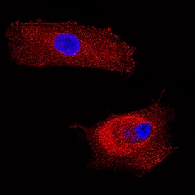 FGL2 was detected in immersion fixed WI-38 human fetal lung fibroblast cell line using Mouse Anti-Human FGL2 Monoclonal Antibody (Catalog # MAB5974) at 3 µg/mL for 3 hours at room temperature. Cells were stained using the NorthernLights™ 557-conjugated Anti-Mouse IgG Secondary Antibody (red; Catalog # NL007) and counterstained with DAPI (blue). Specific staining was localized to cytoplasm. View our protocol for Fluorescent ICC Staining of Cells on Coverslips.