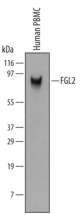 Western Blot FGL2/Fibroleukin Antibody (532223) [Unconjugated]