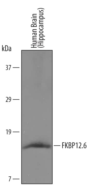 Western blot shows lysates of human brain (hippocampus) tissue. PVDF membrane was probed with 1 µg/mL of Goat Anti-Human/Mouse/Rat FKBP12.6 Biotinylated Antigen Affinity-purified Polyclonal Antibody (Catalog # BAF4174) followed by HRP-conjugated Anti-Goat IgG Secondary Antibody (Catalog # HAF109). A specific band was detected for FKBP12.6 at approximately 12.6 kDa (as indicated). This experiment was conducted under reducing conditions and using Immunoblot Buffer Group 2.