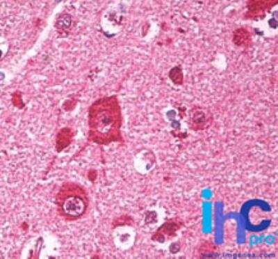 Immunohistochemistry-Paraffin: FNBP1 Antibody [NBP2-24526] - Formalin-fixed, paraffin-embedded human brain stained with FNBP1 antibody at 10 ug/ml. Staining of formalin-fixed tissues is enhanced by boiling tissue sections in 10 mM sodium citrate buffer, pH 6.0 for 10-20 min followed by cooling at RT for 20 min.