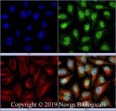 Immunocytochemistry/Immunofluorescence: FOXL2 Antibody [NBP2-70013] - HeLa cells were fixed for 10 minutes using 10% formalin and then permeabilized for 5 minutes using 1X PBS + 0.5% Triton X-100. The cells were incubated with anti-FOXL2 at 2 ug/mL overnight at 4C and detected with an anti-rabbit DyLight 488 (Green) at a 1:500 dilution. Alpha tubulin (DM1A) NB100-690 was used as a co-stain at a 1:1000 dilution and detected with an anti-mouse Dylight 550 (Red) at a 1:500 dilution. Nuclei were counterstained with DAPI (Blue). Cells were imaged using a 40X objective.