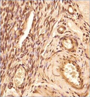 Immunohistochemistry-Paraffin: FOXL2 Antibody [NBP2-70013] - Analysis of a FFPE tissue section of the human ovary using 1:200 dilution of FOXL2 antibody (NBP2-70013). The signal was developed using HRP-DAB method which followed counterstaining of the cells with hematoxylin. The antibody generated mainly a nuclear staining with weak cytoplasmic positivity.