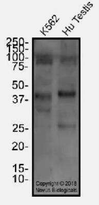 Western Blot: FOXL2 Antibody [NBP2-70013] - Total protein from K562 and human testis was separated on a 12% gel by SDS-PAGE, transferred to PVDF membrane and blocked in 5% non-fat milk in TBST. The membrane was probed with 2.0 ug/mL anti-FOXL2 in 1% block buffer and detected with an anti-rabbit HRP secondary antibody using chemiluminescence.