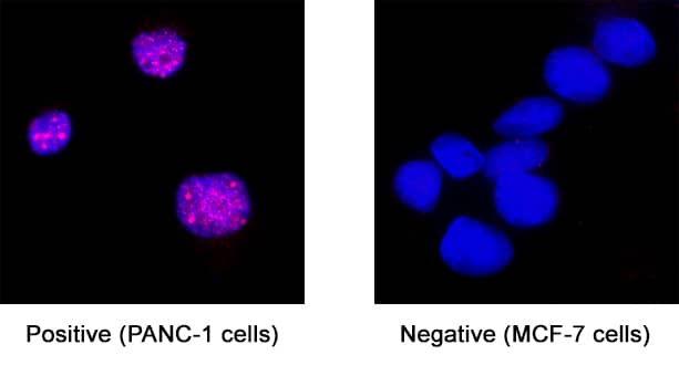 FOXL2 was detected in immersion fixed PANC-1 human pancreatic carcinoma cell line (positive) and MCF-7 human breast cancer cell line (negative) using Mouse Anti-Human FOXL2 Monoclonal Antibody (Catalog # MAB10396) at 8 µg/mL for 3 hours at room temperature. Cells were stained using the NorthernLights™ 557-conjugated Anti-Mouse IgG Secondary Antibody (red; Catalog # NL007) and counterstained with DAPI (blue). Specific staining was localized to cell nuclei. View our protocol for Fluorescent ICC Staining of Cells on Coverslips.