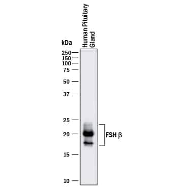 Western blot shows lysates of human pituitary gland tissue. PVDF membrane was probed with 2 µg/mL of Rat Anti-Human FSH  beta  Monoclonal Antibody (Catalog # MAB43101) followed by HRP-conjugated Anti-Rat IgG Secondary Antibody (Catalog # HAF005). Specific bands were detected for FSH  beta  at approximately 18-24 kDa (as indicated). This experiment was conducted under reducing conditions and using Immunoblot Buffer Group 1.