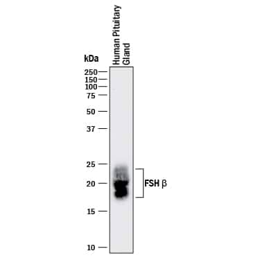 Western blot shows lysates of human pituitary gland tissue. PVDF membrane was probed with 1 µg/mL of Rat Anti-Human FSH  beta  Monoclonal Antibody (Catalog # MAB43102) followed by HRP-conjugated Anti-Rat IgG Secondary Antibody (Catalog # HAF005). Specific bands were detected for FSH  beta  at approximately 18-24 kDa (as indicated). This experiment was conducted under reducing conditions and using Immunoblot Buffer Group 1.