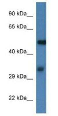 Western Blot: Fascin Antibody [NBP1-74212] - Mouse Thymus Lysate 1ug/ml Gel Concentration 12%