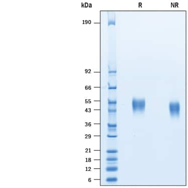 2 μg/lane of Biotinylated Recombinant Human Fc gamma RIIIA/CD16a His-tag Avi-tag (Catalog # AVI10468) was  resolved with SDS-PAGE under reducing (R) and non-reducing (NR)  conditions and visualized by Coomassie® Blue staining, showing bands at kDa.