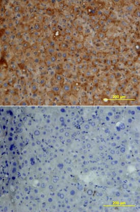 Fetuin A/AHSG was detected in immersion fixed paraffin-embedded sections of human liver array using Goat Anti-Human Fetuin A/AHSG Antigen Affinity-purified Polyclonal Antibody (Catalog # AF1184) at 15 µg/mL overnight at 4 °C. Tissue was stained using the Anti-Goat HRP-DAB Cell & Tissue Staining Kit (brown; Catalog # CTS008) and counterstained with hematoxylin (blue). Lower panel shows a lack of labeling if primary antibodies are omitted and tissue is stained only with secondary antibody followed by incubation with detection reagents. View our protocol for Chromogenic IHC Staining of Paraffin-embedded Tissue Sections.